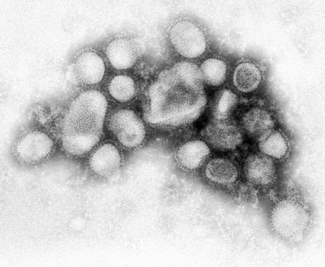 Lehet, hogy jön az új típusú H1N1